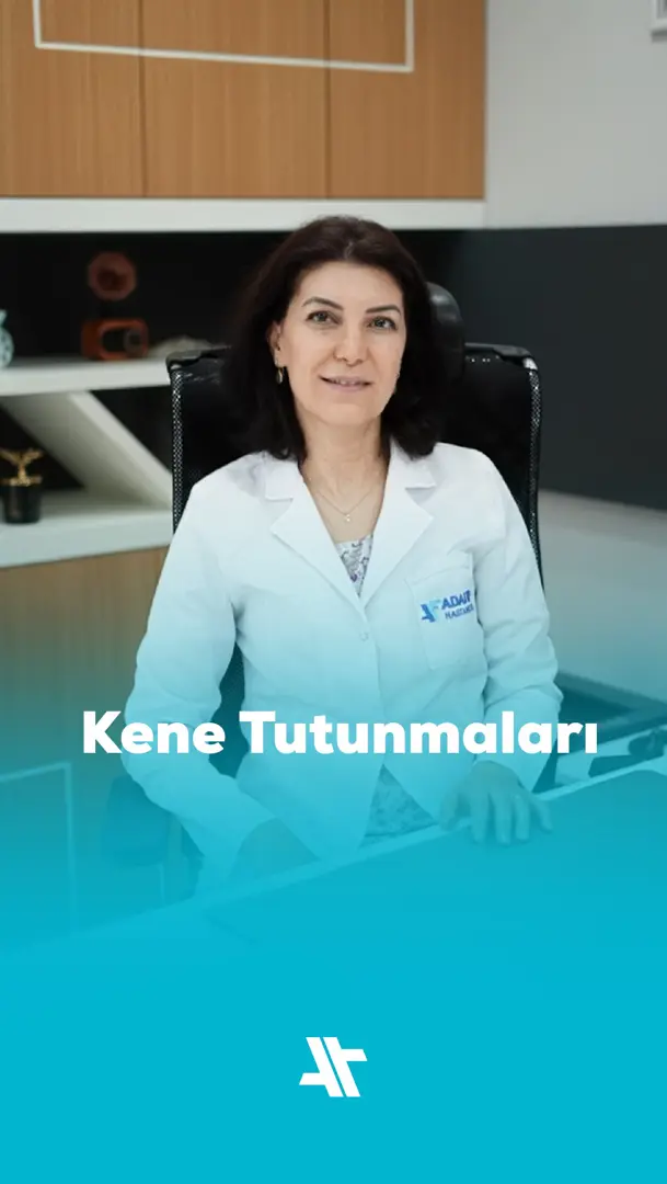 Kene tutunmaları
